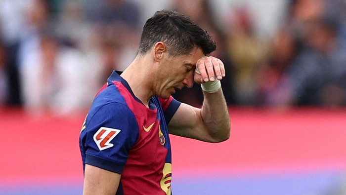 Lewandowski Cedera, Bisa Absen Lawan Madrid dan Inter